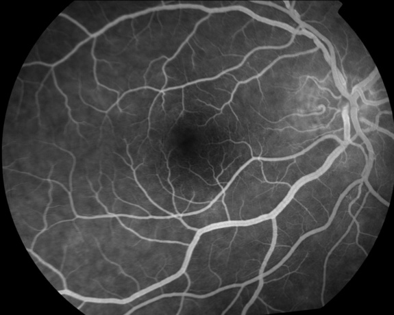 Normal Retinal Anatomy - The Retina Reference