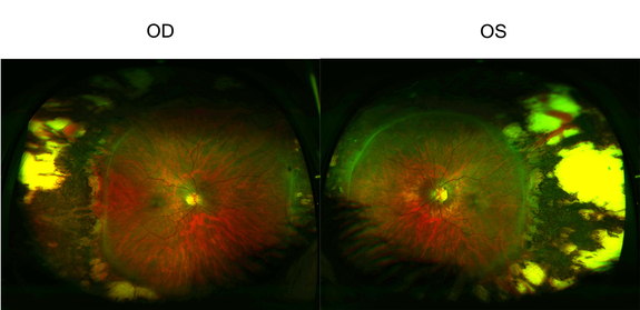 Normal Retinal Anatomy - The Retina Reference